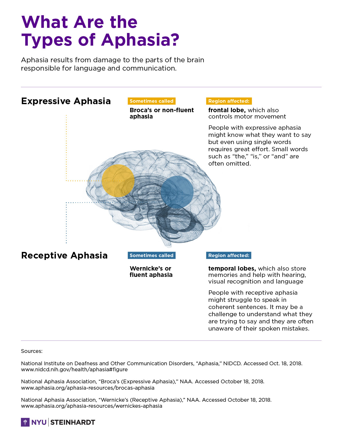 Illustration showing which parts of the brain, when damaged, can cause expressive and receptive aphasia.